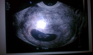 gracelee ultrasound